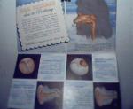 Auralgan for Treatment of Water in Ear!
